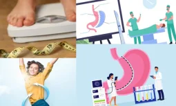 Mide Küçültme Ameliyatı Tekrar Yapılabilir Mi?