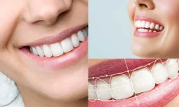 Düzce Gülüş Tasarımı Nedir ve Neden Tercih Edilir?