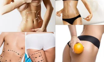 Meme Dikleştirme Ameliyatı Kimlere Yapılır?