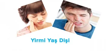 Yirmi Yaş Dişiniz Sinyal Veriyor Olabilir