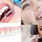 Türkiye'de Diş Kliniği - كلينك اسنان في تركيا Kolay Bulunur Mu?