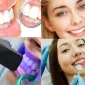 Diş Beyazlatma: Daha Parlak Bir Gülüş İçin Etkili Yöntemler